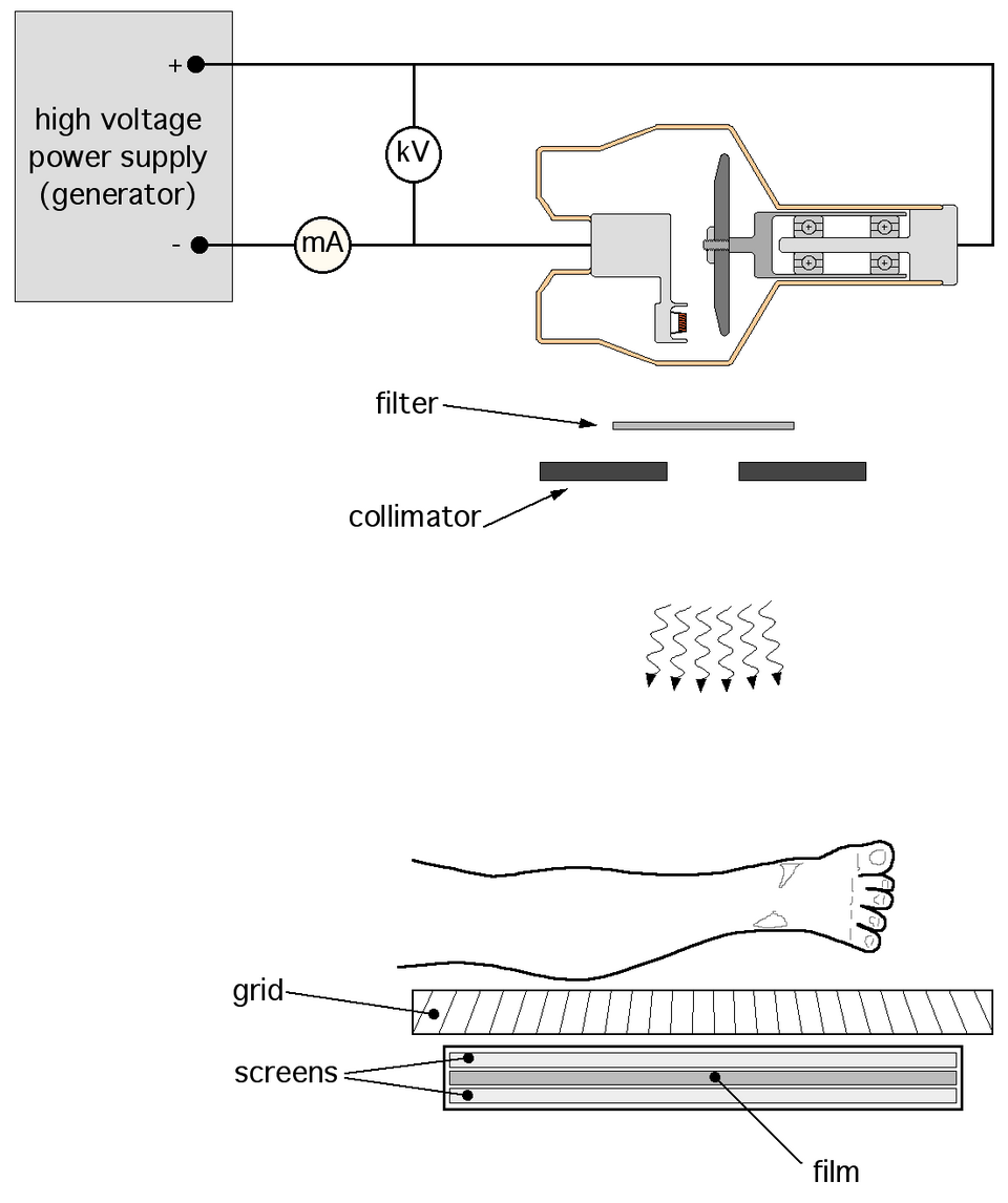 X線管の模式図（陰極フィラメント、陽極ターゲット、電子線とX線の放射）